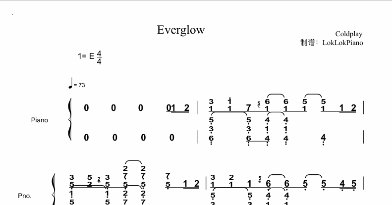 图片[2]-Everglow  Coldplay （酷玩乐队） 钢琴谱  曲谱 独奏琴谱（共3页）